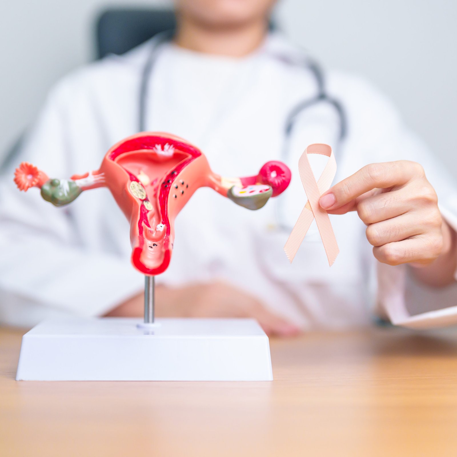 Doctor holding Peach ribbon with Uterus and Ovaries model for September Uterine Cancer Awareness month. Endometriosis, Hysterectomy, Uterine fibroids, Reproductive, Healthcare and World cancer day