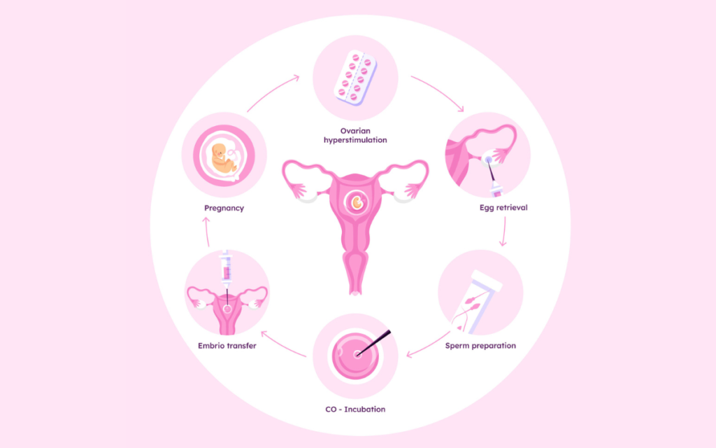 IVF Doctor